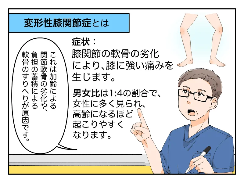 変形性膝関節症とは。症状：膝関節の軟骨の劣化により、膝に強い痛みを生じます。男女比は、１：４の割合で女性に多くみられ、高齢になるほど起こりやすくなります。「これは加齢による関節軟骨の劣化や、負担の蓄積による軟骨のすりへりが原因です。」